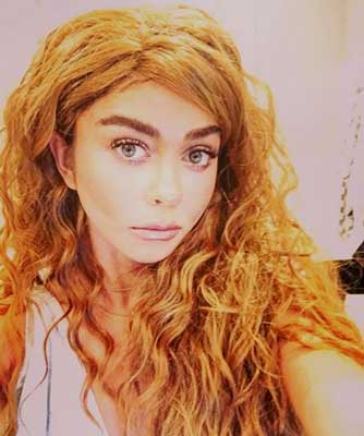 Sarah-Hyland-est-malade-de-dysplasie-renale